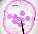 nematodemale