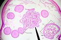 nematode2