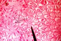 tapeworm eggs