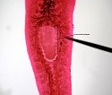 planaria2