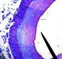 artery2