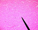 cardiacmuscle2