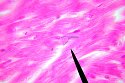 cardiacmuscle4
