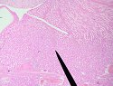 kidney1