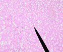 kidney2