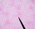 kidney3