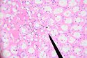 kidney4