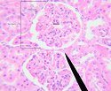 kidney5
