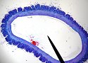 vein1
