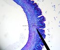 vein2